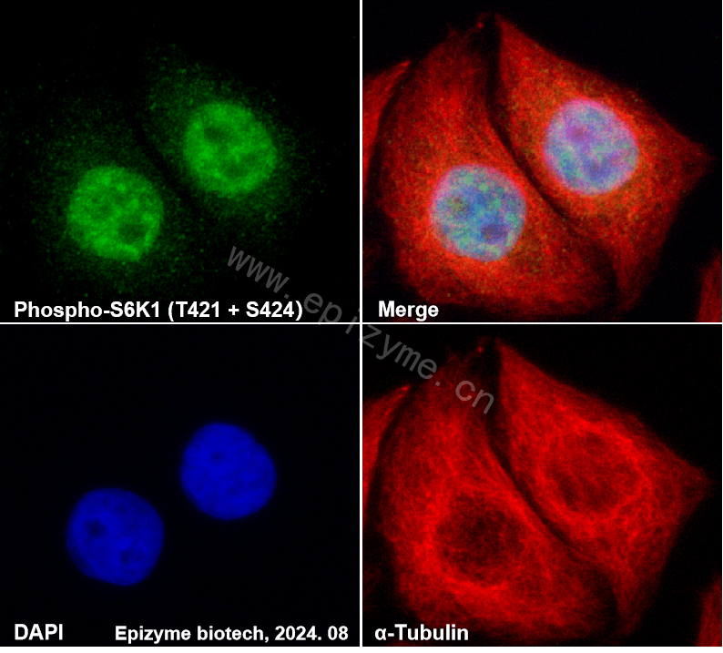 Anti-Phospho-S6K1 (T421/S424) Rabbit mAb [92E29K97]
