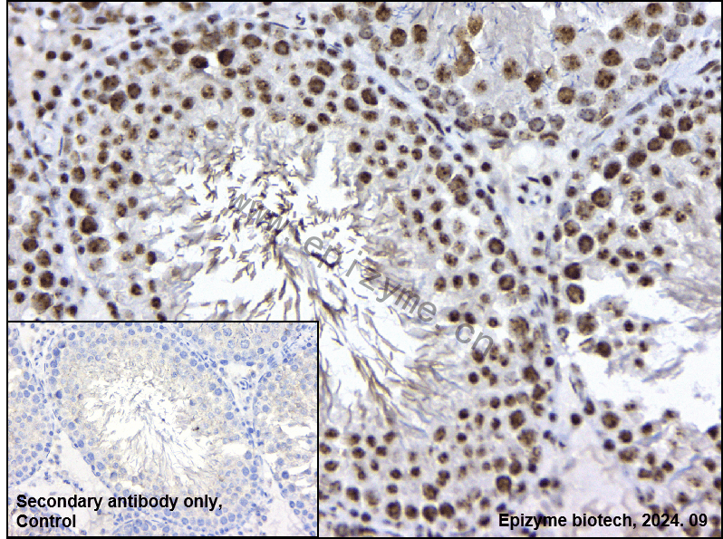 Anti-Phospho-S6K1 (T421/S424) Rabbit mAb [92E29K97]