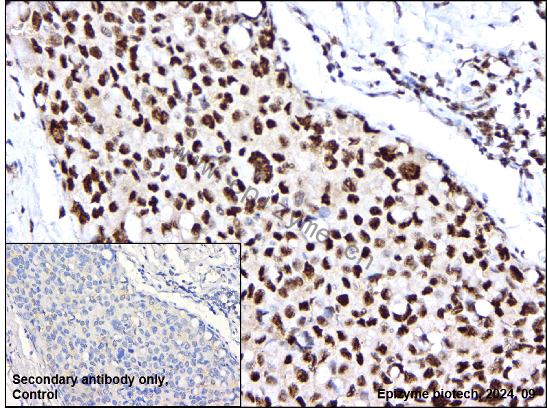 Anti-Phospho-S6K1 (T421/S424) Rabbit mAb [92E29K97]