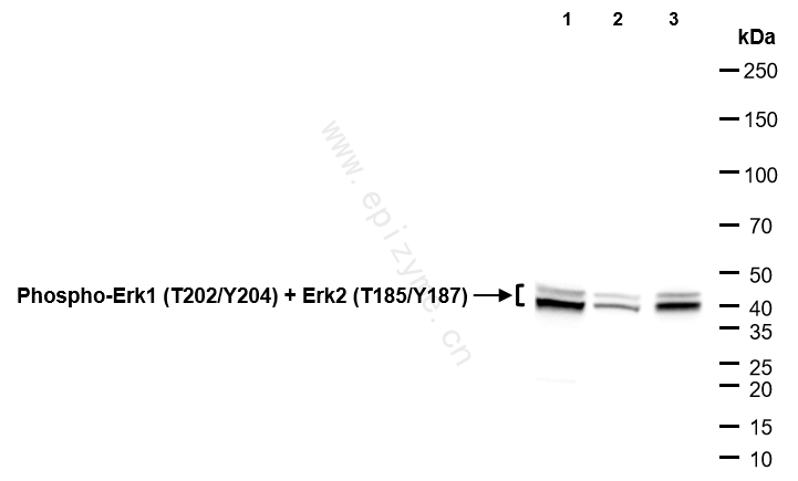 Anti-Phospho-ERK1 (T202/Y204)/ERK2 (T185/Y187) Rabbit mAb [67S45G56]
