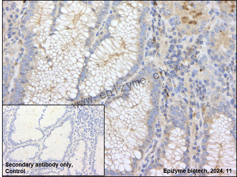 Anti-Phospho-ERK1 (T202/Y204)/ERK2 (T185/Y187) Rabbit mAb [67S45G56]