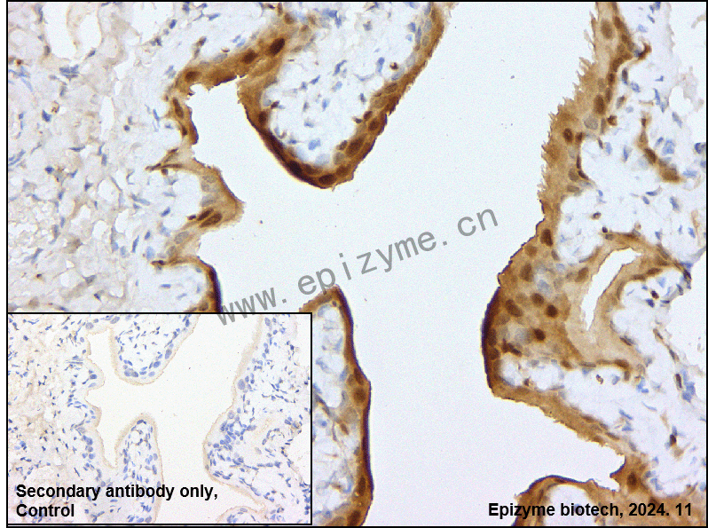 Anti-Phospho-ERK1 (T202/Y204)/ERK2 (T185/Y187) Rabbit mAb [67S45G56]