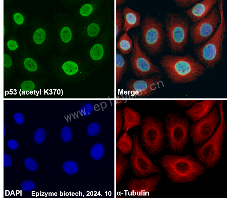 Anti-Acetyl-p53 (Lys370) Rabbit mAb [29J79R81]