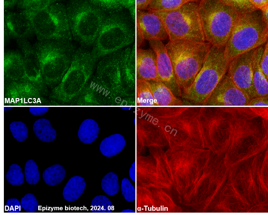Anti-MAP1LC3A Rabbit mAb [59O19F62]