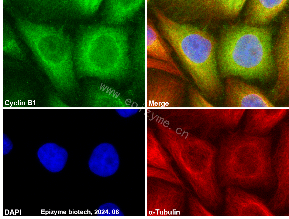 Anti-Cyclin B1 Rabbit mAb [98A32L21]