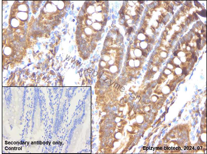 Anti-Cyclin B1 Rabbit mAb [98A32L21]
