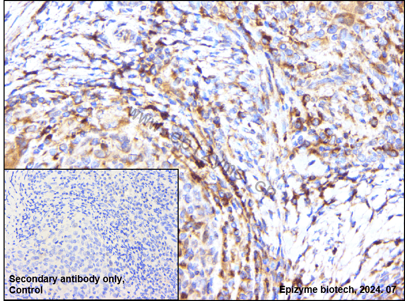 Anti-Cyclin B1 Rabbit mAb [98A32L21]