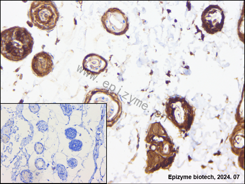Anti-Cyclin B1 Rabbit mAb [98A32L21]