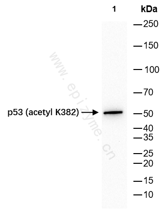 Anti-Acetyl-p53 (Lys382) Rabbit mAb [89D56L95]
