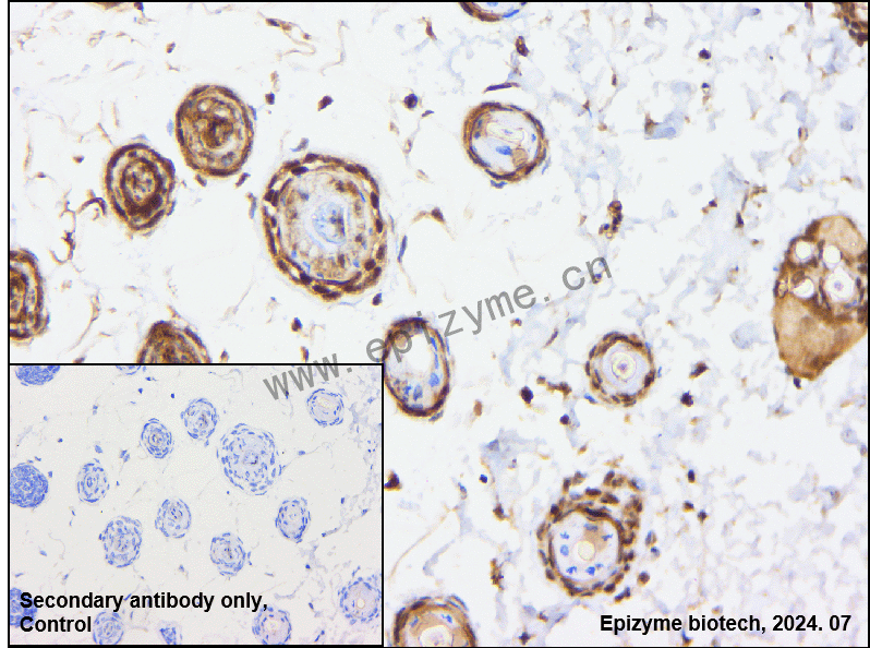 Anti-Acetyl-p53 (Lys382) Rabbit mAb [89D56L95]