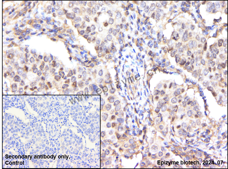 Anti-Acetyl-p53 (Lys382) Rabbit mAb [89D56L95]