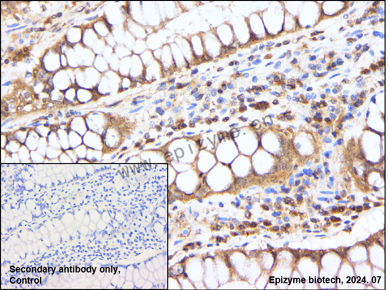 Anti-Acetyl-p53 (Lys382) Rabbit mAb [89D56L95]