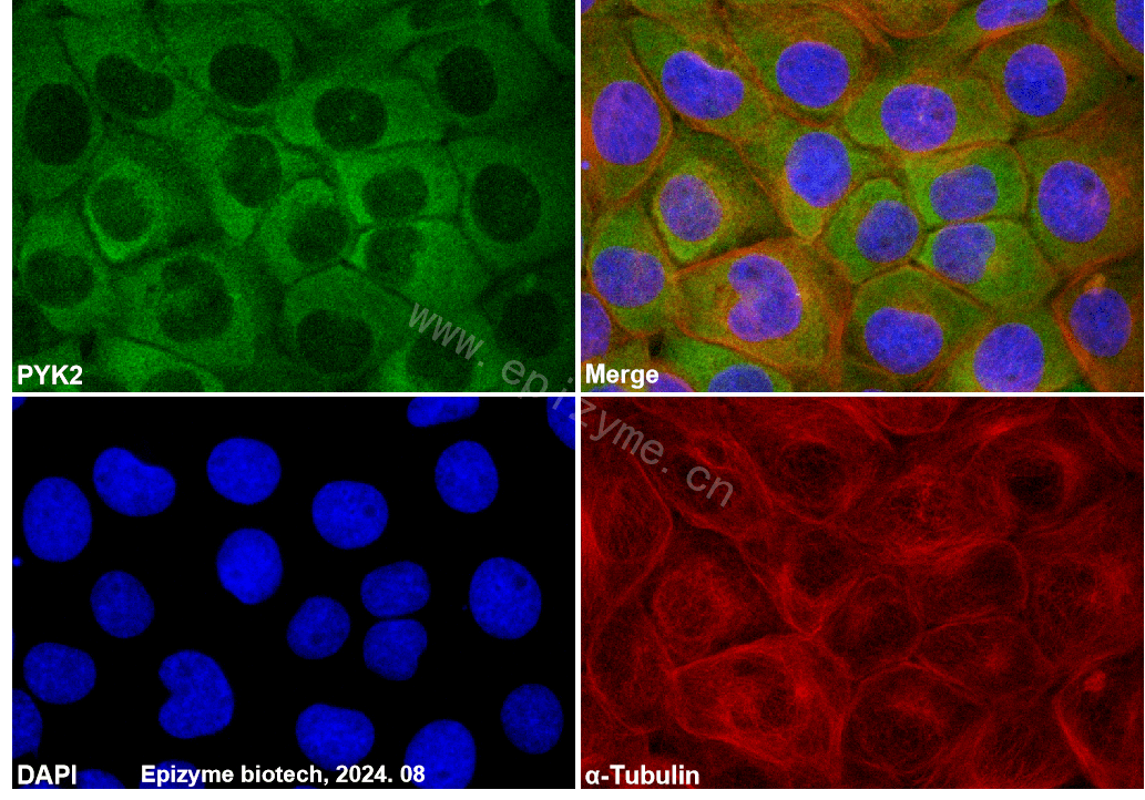 Anti-PYK2 Rabbit mAb [27M26C08]