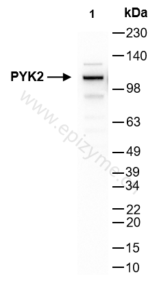 Anti-PYK2 Rabbit mAb [27M26C08]