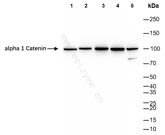 Anti-alpha Catenin Rabbit mAb [98O31L91]