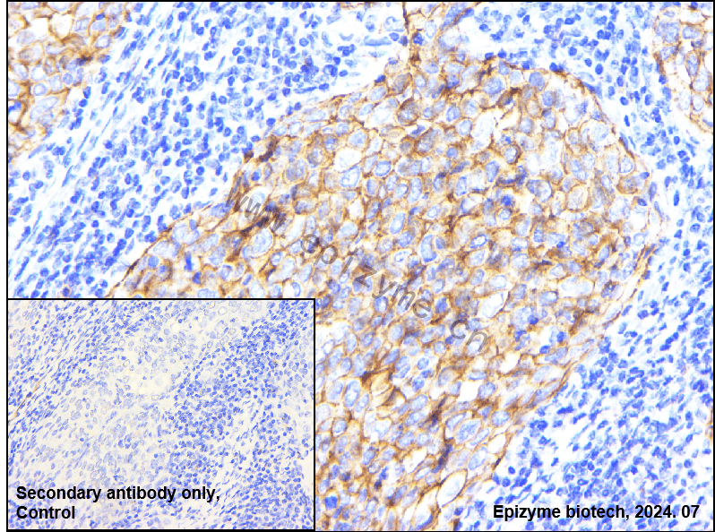 Anti-alpha Catenin Rabbit mAb [98O31L91]