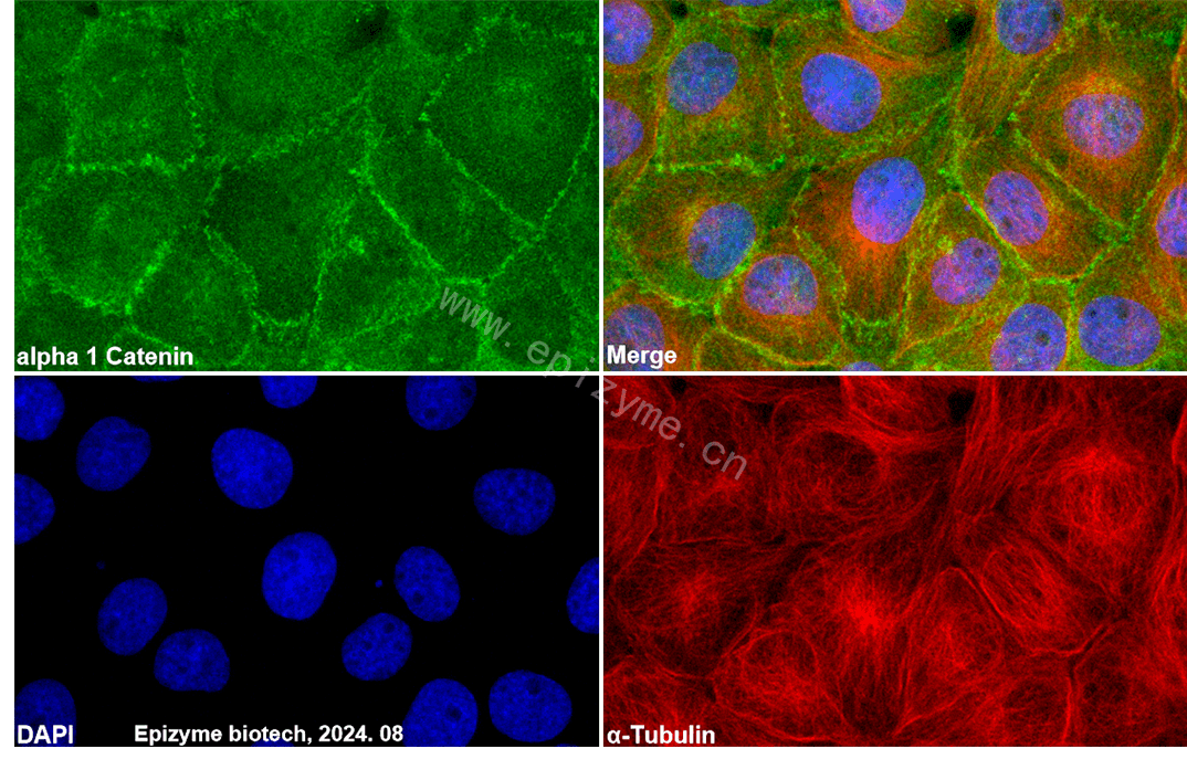 Anti-alpha Catenin Rabbit mAb [98O31L91]