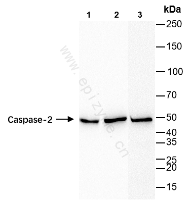 Anti-Caspase-2 Rabbit mAb [42O33T75]