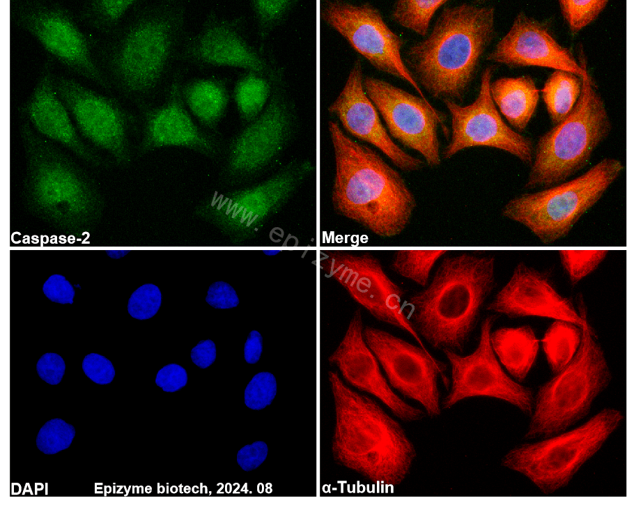 Anti-Caspase-2 Rabbit mAb [42O33T75]