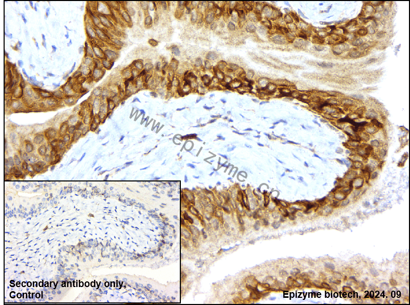 Anti-Caspase-2 Rabbit mAb [42O33T75]