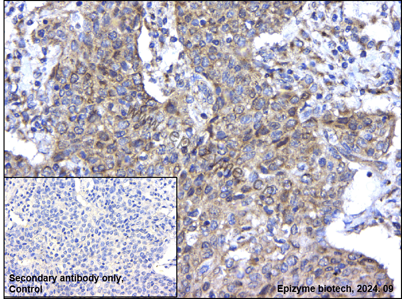 Anti-Caspase-2 Rabbit mAb [42O33T75]
