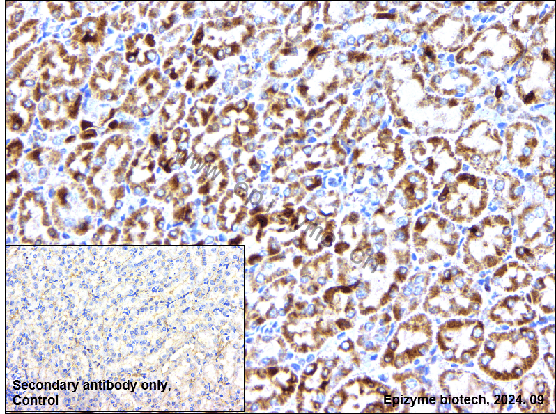 Anti-Caspase-2 Rabbit mAb [42O33T75]