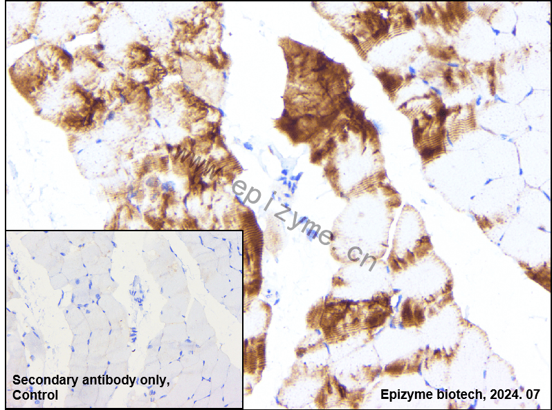 Anti-Tissue Factor Rabbit mAb [17P89P94]