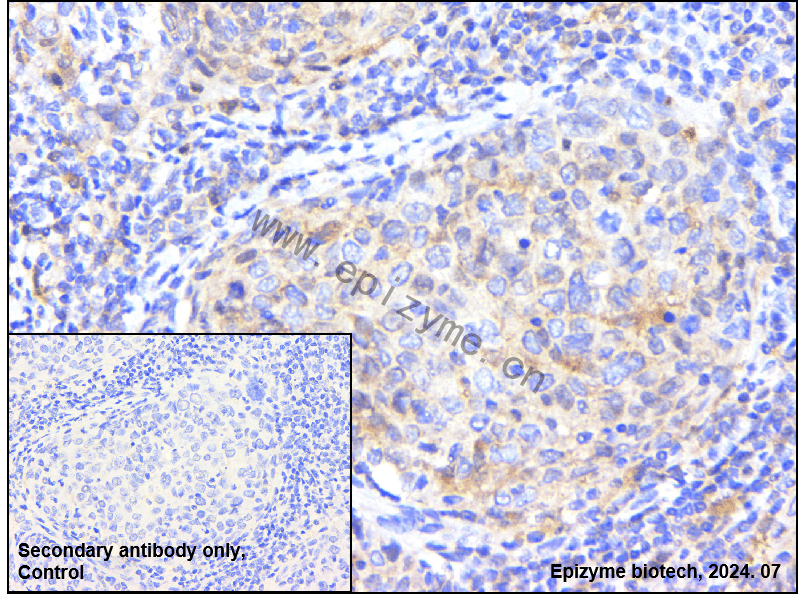 Anti-Tissue Factor Rabbit mAb [17P89P94]
