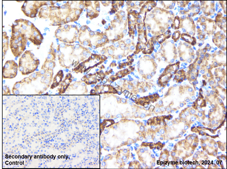 Anti-Tissue Factor Rabbit mAb [17P89P94]
