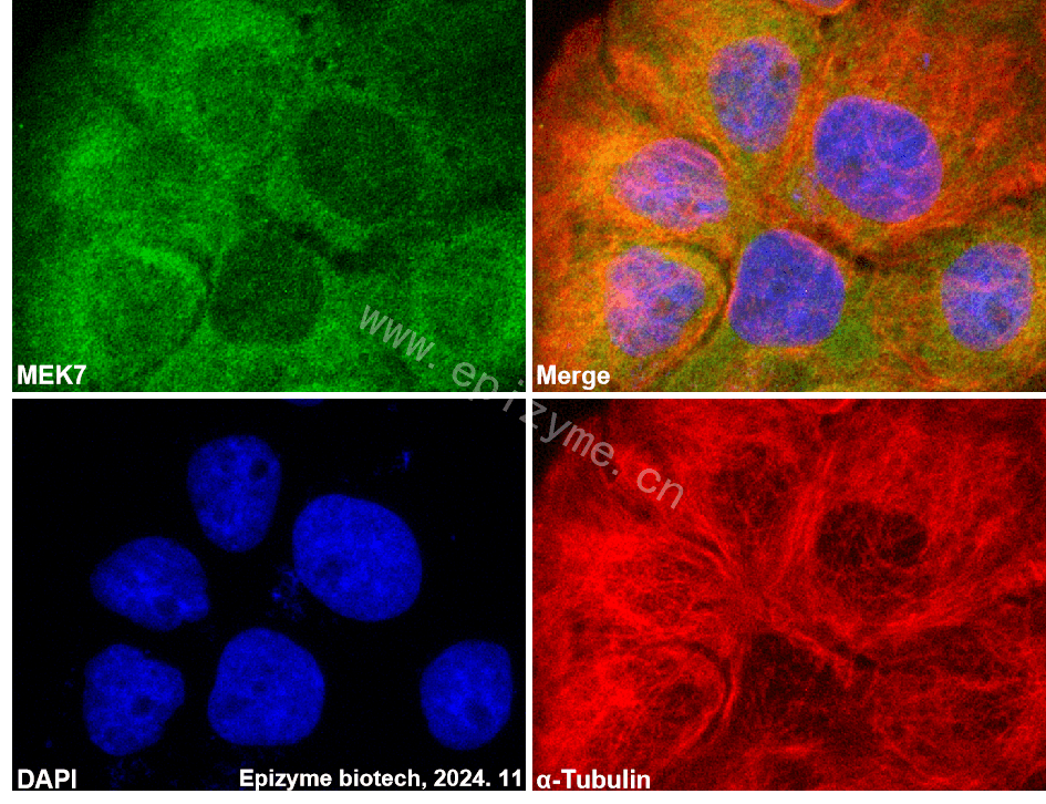 Anti-MEK7 Rabbit mAb [40E23B91]
