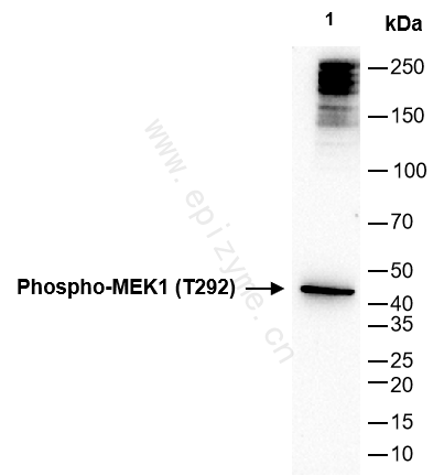 Anti-Phospho-MEK1 (Thr292) Rabbit mAb [68A07N13]