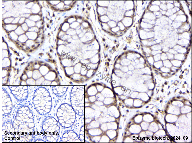 Anti-Phospho-MEK1 (Thr292) Rabbit mAb [68A07N13]