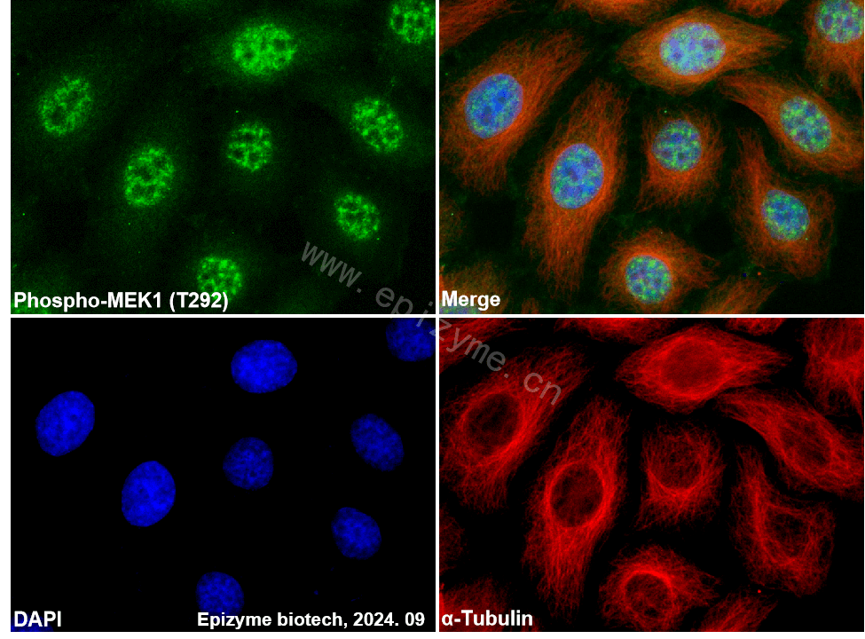Anti-Phospho-MEK1 (Thr292) Rabbit mAb [68A07N13]