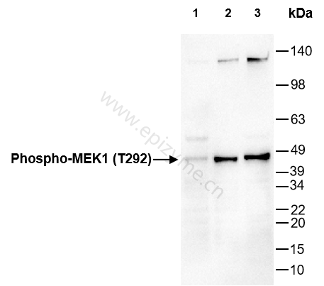Anti-Phospho-MEK1 (Thr292) Rabbit mAb [68A07N13]