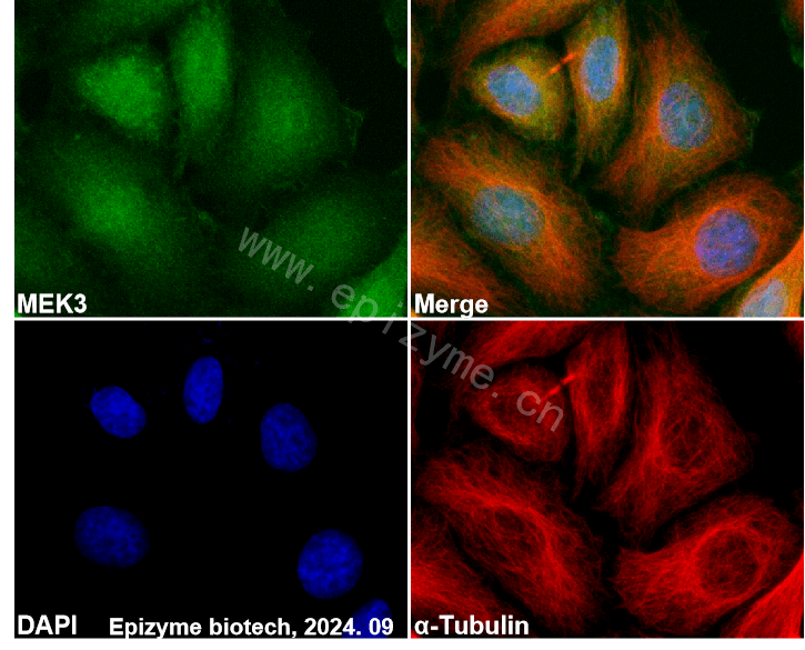 Anti-MEK3 Rabbit mAb [56Q67T62]