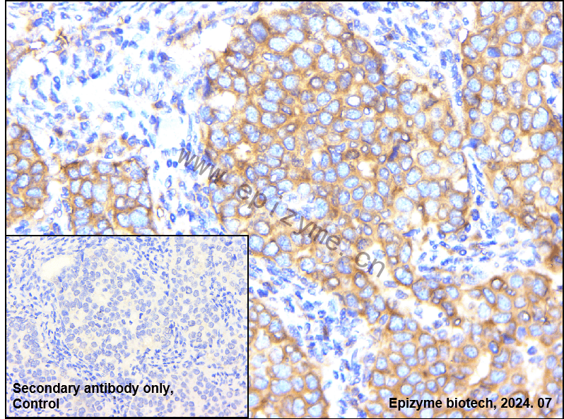 Anti-HDAC6 Rabbit mAb [15B26D52]
