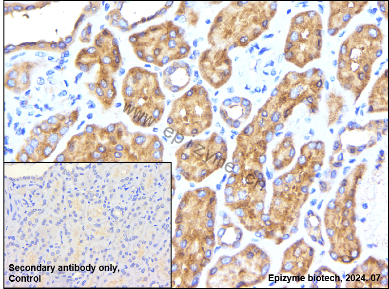 Anti-HDAC6 Rabbit mAb [15B26D52]