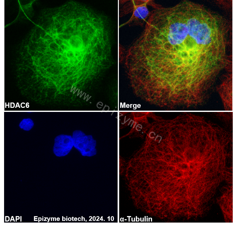 Anti-HDAC6 Rabbit mAb [15B26D52]