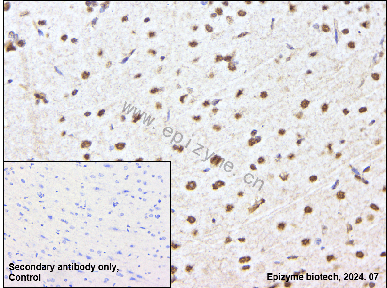 Anti-HDAC9 Rabbit mAb [74Q59D98]
