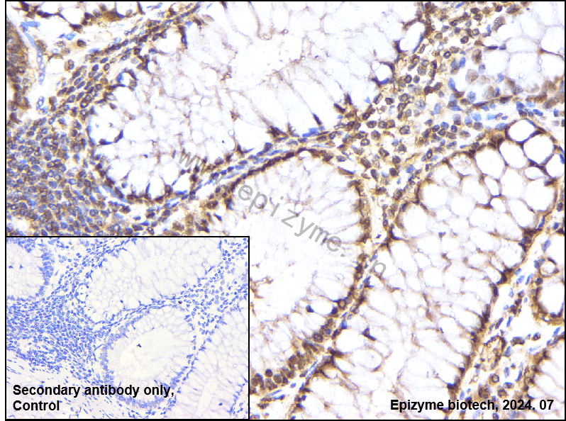 Anti-HDAC9 Rabbit mAb [74Q59D98]
