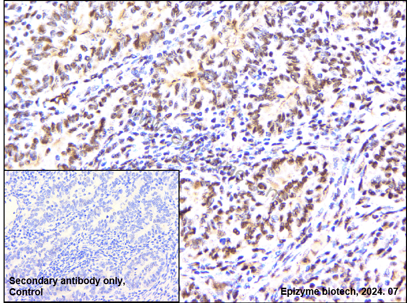 Anti-HDAC9 Rabbit mAb [74Q59D98]