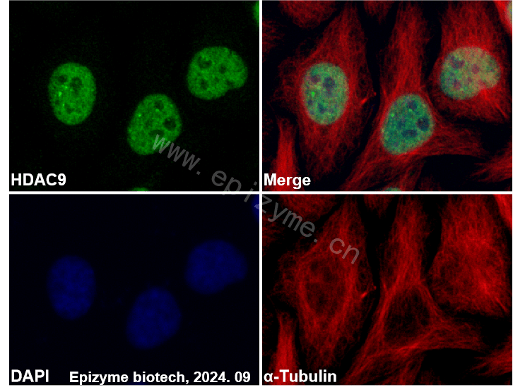 Anti-HDAC9 Rabbit mAb [74Q59D98]