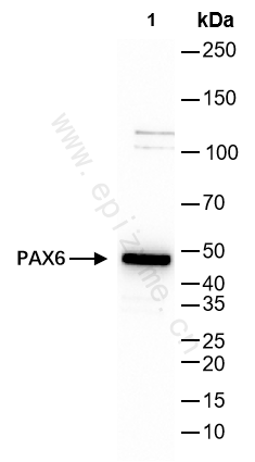 Anti-PAX6 Rabbit mAb [92G96O01]