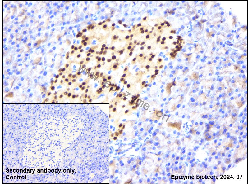 Anti-PAX6 Rabbit mAb [92G96O01]
