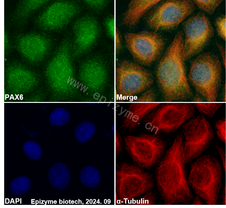 Anti-PAX6 Rabbit mAb [92G96O01]