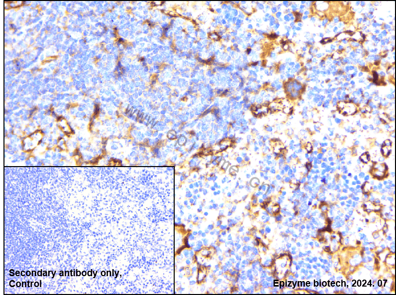 Anti-MEKK3 Rabbit mAb [88N92G19]
