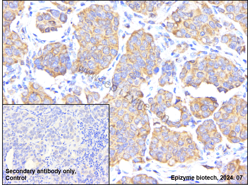 Anti-MEKK3 Rabbit mAb [88N92G19]