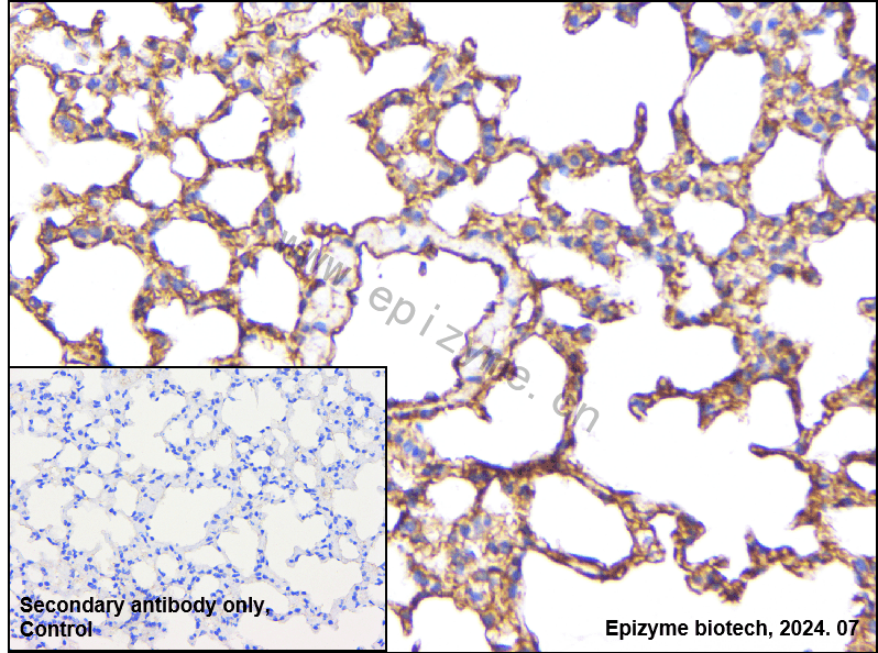 Anti-MEKK3 Rabbit mAb [88N92G19]