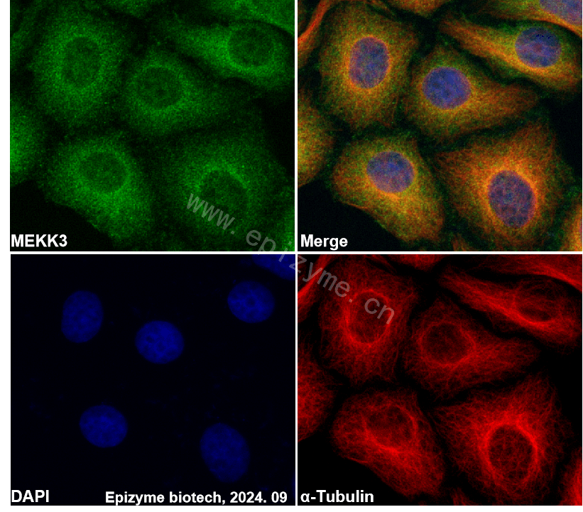 Anti-MEKK3 Rabbit mAb [88N92G19]