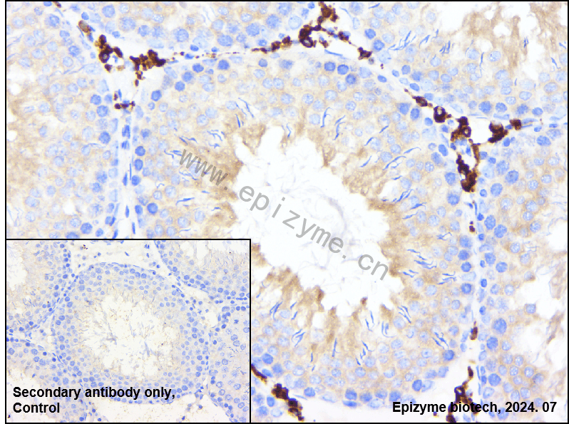 Anti-ATG3 Rabbit mAb [98P21J87]